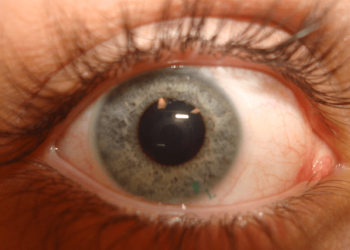 How To Care For Your Eyes While Travelling