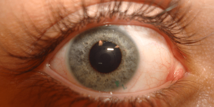How To Care For Your Eyes While Travelling